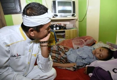  BERITA PURWAKARTA - BERITA PURWAKARTA HARI INI - SPIRIT JAWA BARAT -  Dedi Memotivasi Bocah Osteogenesis
